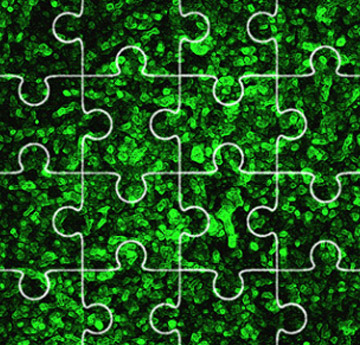 Cardiac Cell desynchronization