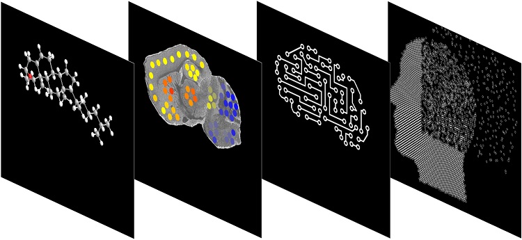 Researchers develop new method to map cholesterol metabolism in brain