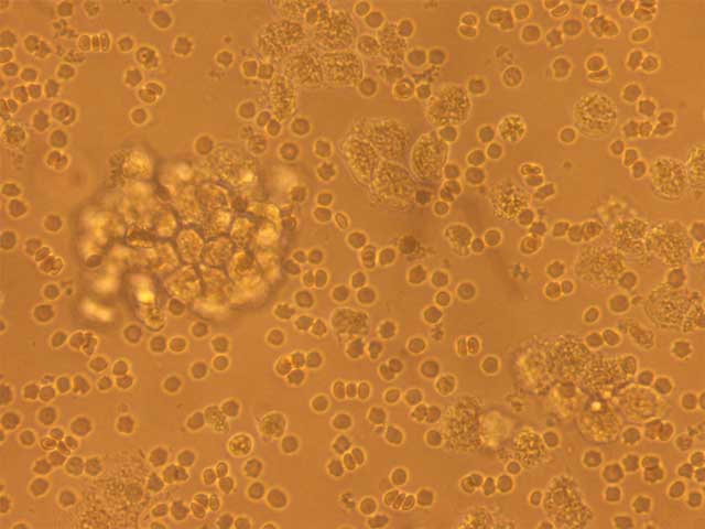 A cell under a microscope, covered in brown