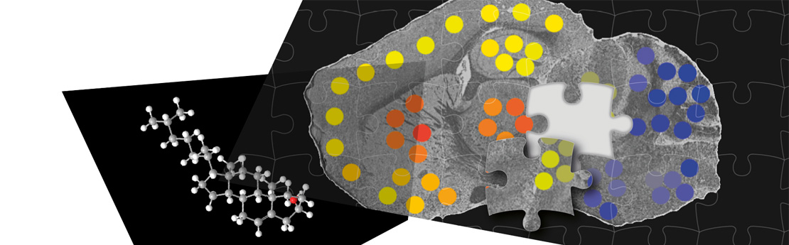 We are piecing together cholesterol chemistry in brain function