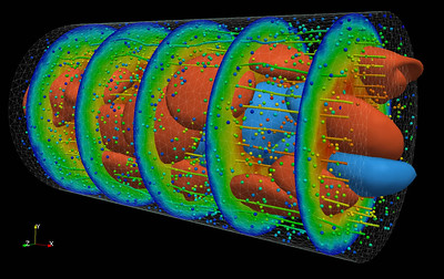 CFD image of artery